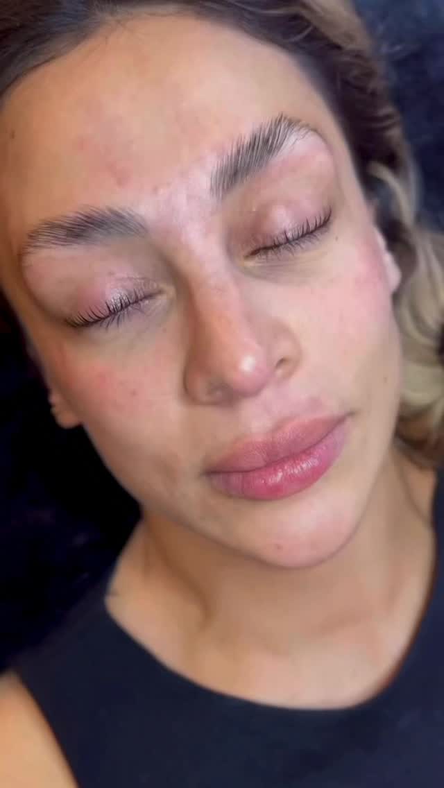 BAKIŞLAR DEĞİŞİYOR 💫 😍

Kirpik Lifting ile 2 Ay Boyunca Mascara Etkiyle Tanışma Zamanı 

#ki̇rpi̇kli̇fti̇ng #ipekkirpikistanbul #kirpikuzatma #kirpikbakımı #kirpikserumu